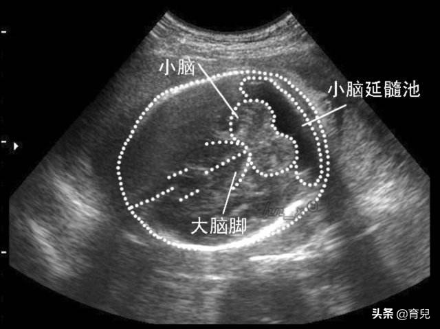 今日科普一下！脑瘫女孩备孕被指责,百科词条爱好_2024最新更新