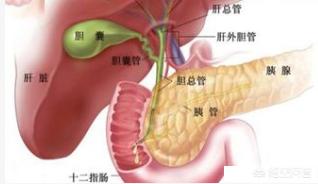 今日科普一下！胆囊藏400多颗结石,百科词条爱好_2024最新更新