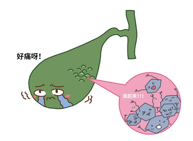 今日科普一下！胆囊藏400多颗结石,百科词条爱好_2024最新更新