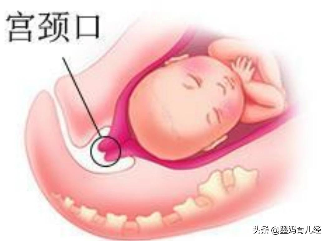 今日科普一下！产前4小时才知怀孕,百科词条爱好_2024最新更新