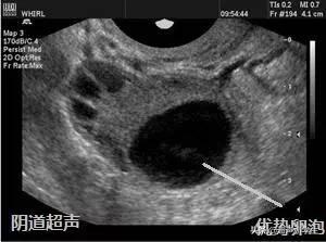 今日科普一下！60岁孕妇成功分娩,百科词条爱好_2024最新更新